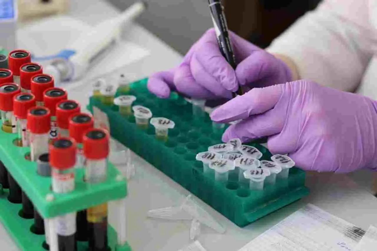 Cistite persistente: potrebbe nascondere altre patologie Immagine selezionata