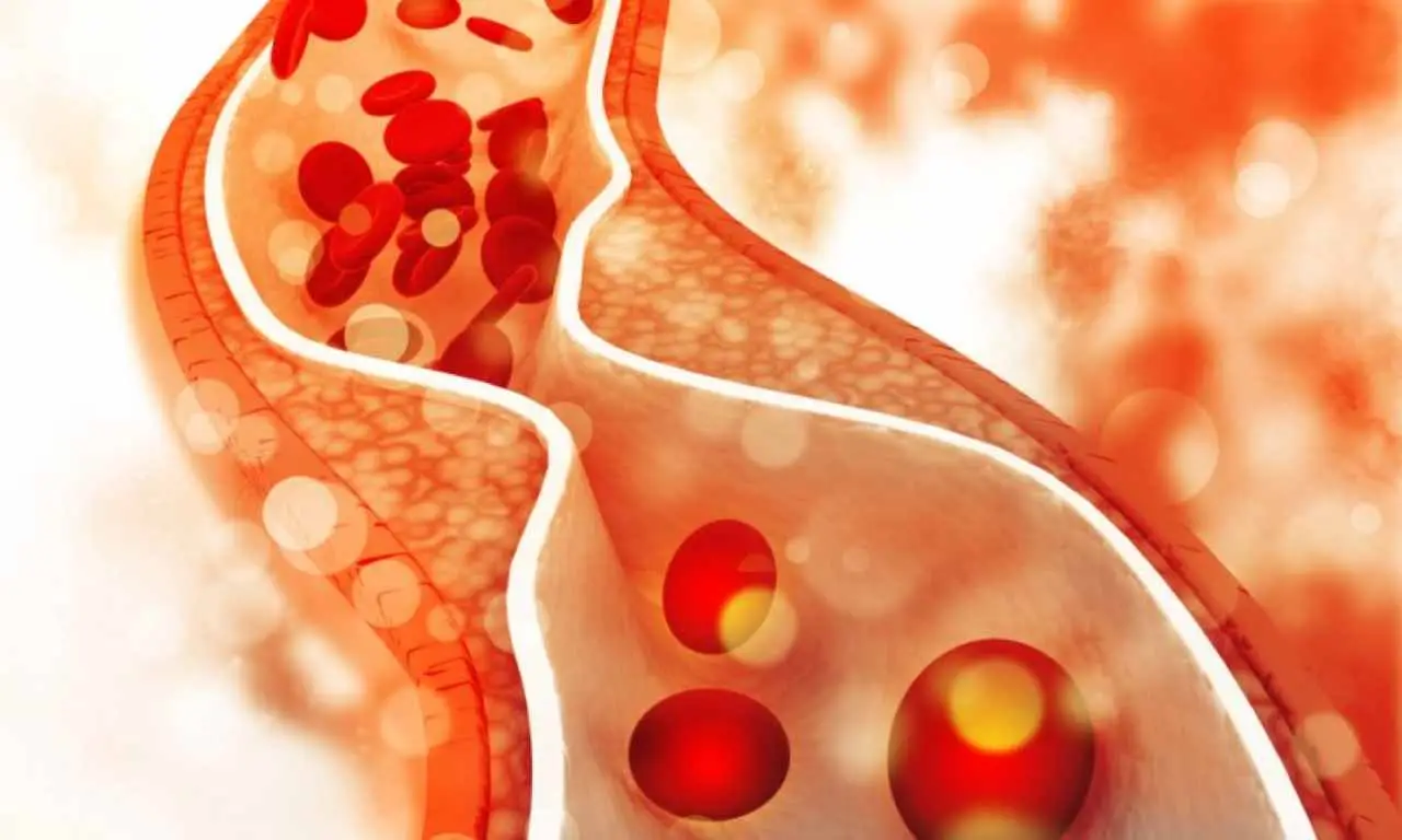 Colesterolo più basso in 10 giorni: ecco il piano alimentare da seguire Immagine selezionata